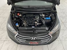 Hyundai HB20S COMFORT PLUS 1.0 2017 SÓ MOTOS E AUTOMÓVEIS SANTA CRUZ DO SUL / Carros no Vale